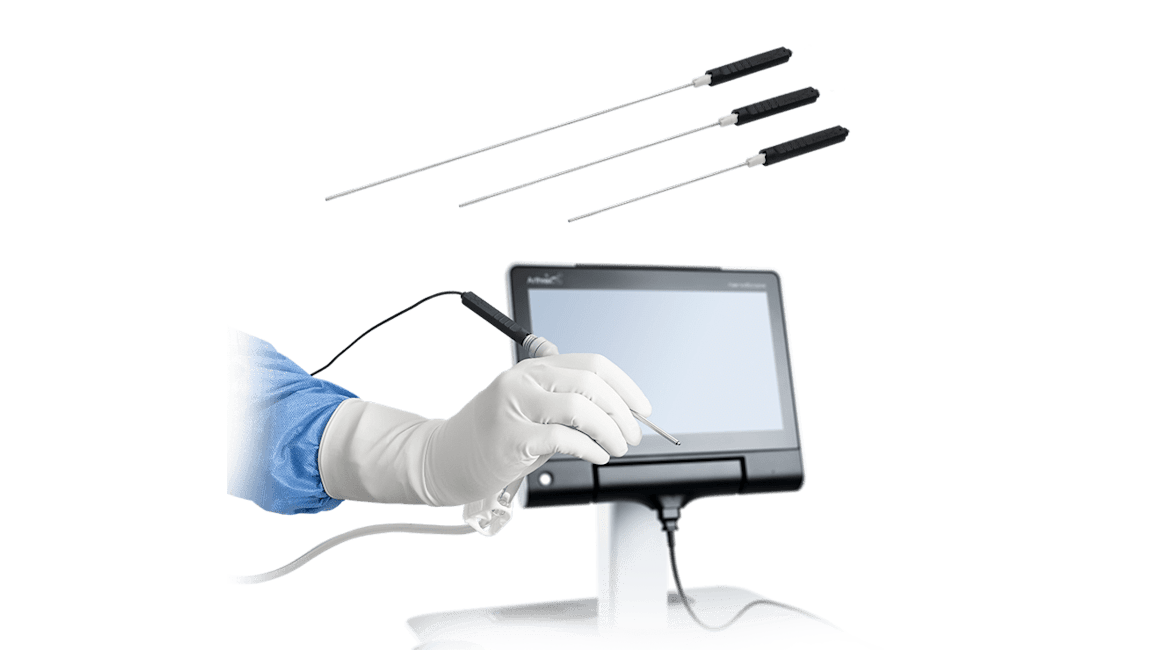 Arthrex - Imaging and Resection Arthrex - Imaging and Resection